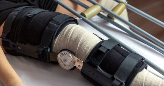 Leg in a cast - surgery when you live on a boat