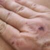 Hand with minor injuries - minor injuries during boat project