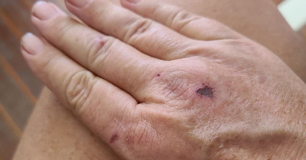 Hand with minor injuries - minor injuries during boat project