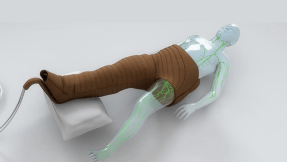 Flexi-Touch pneumatic compression pump system used to treat lymphedema