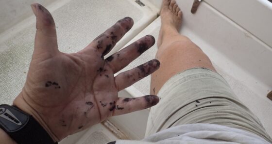 Hands coated with epoxy